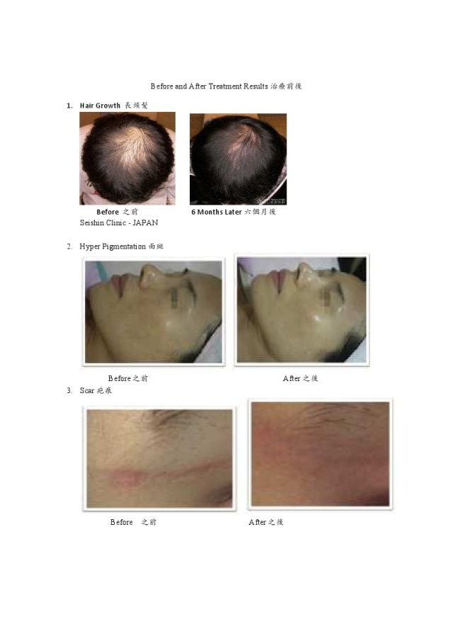 Before and After Treatment Results 1