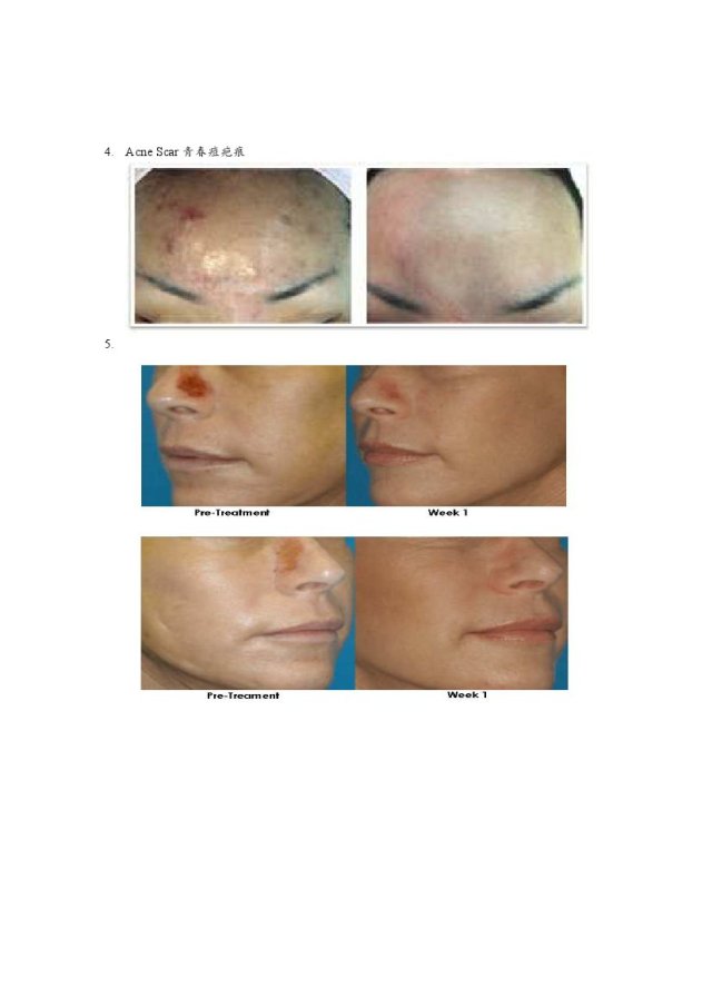 Before and After Treatment Results 2
