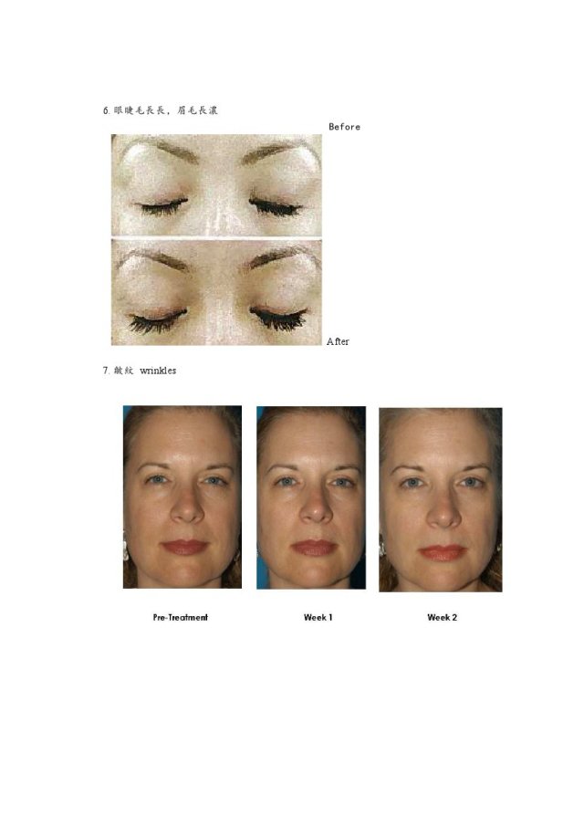 Before and After Treatment Results 3
